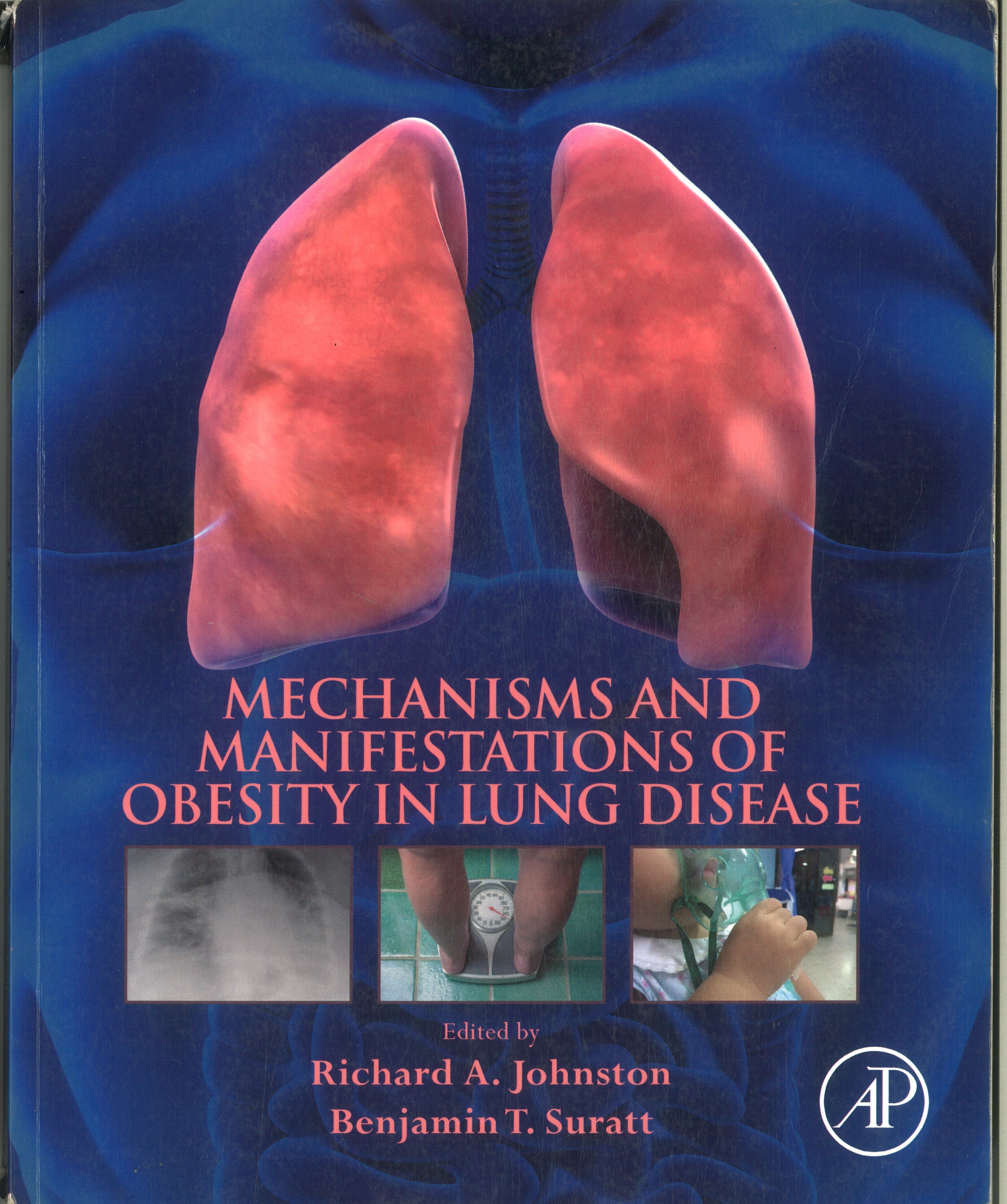 Mechanisms and Manifestations of Obesity in Lung Disease