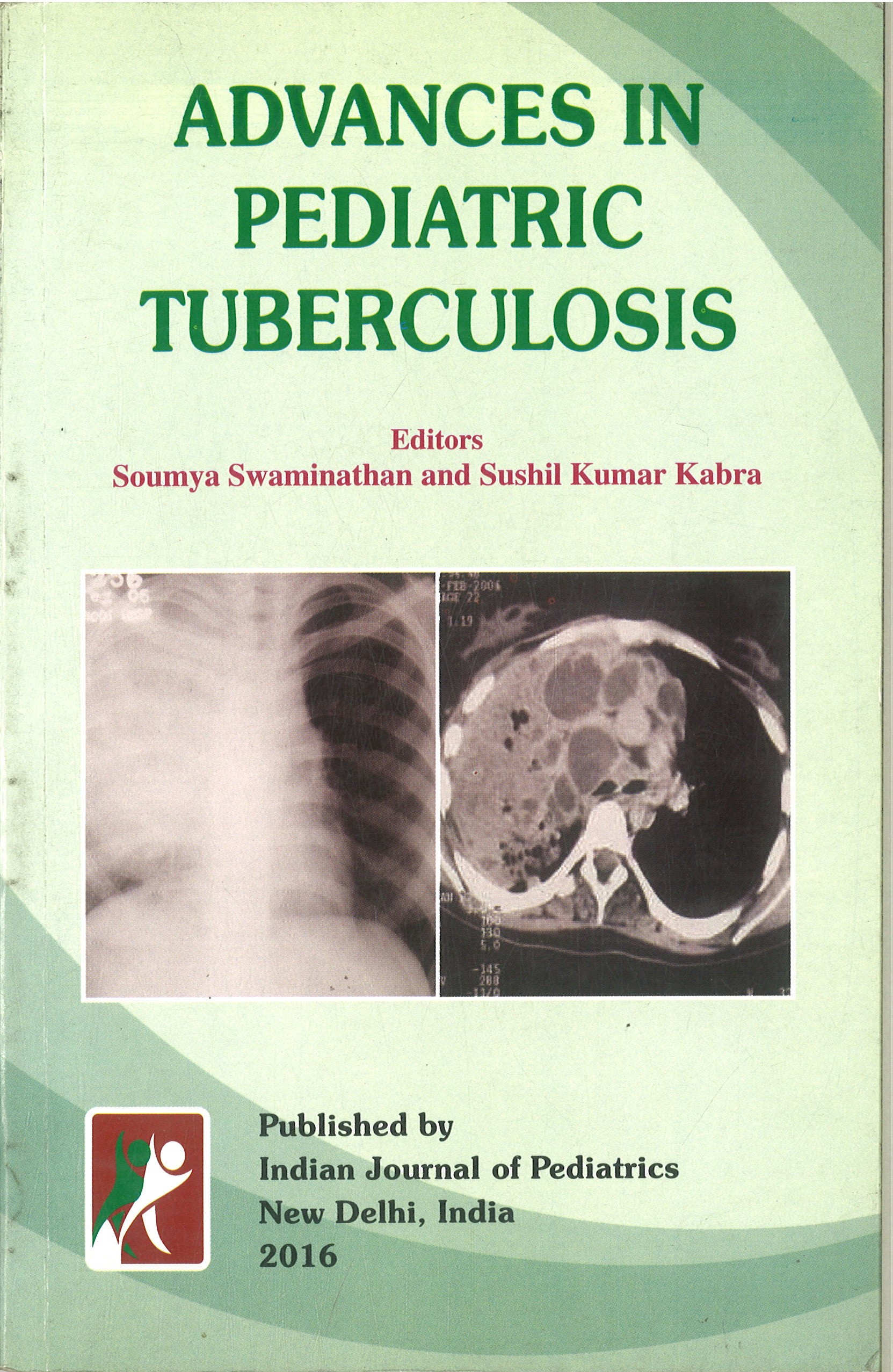Advances in Pediatric Tuberculosis